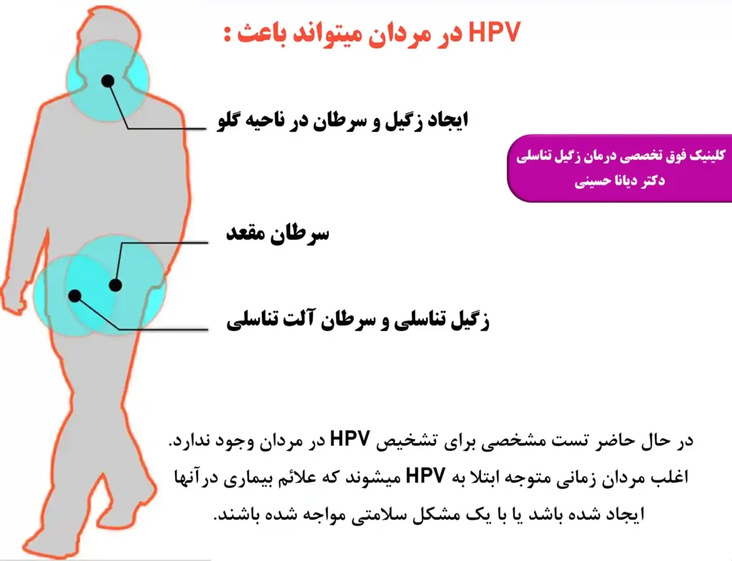 HPV در مردان - بهترین پزشک زگیل تناسلی مشهد