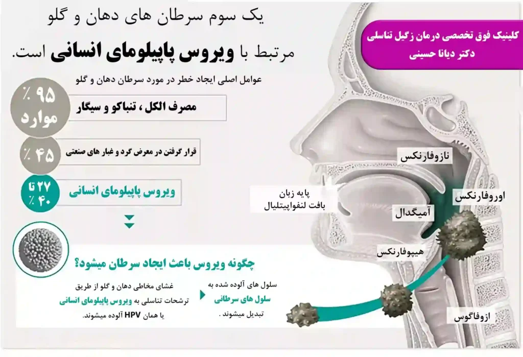 اطلاعاتی در مورد سرطان دهان و گلو - دکتر دیانا حسینی بهترین دکتر HPV مشهد