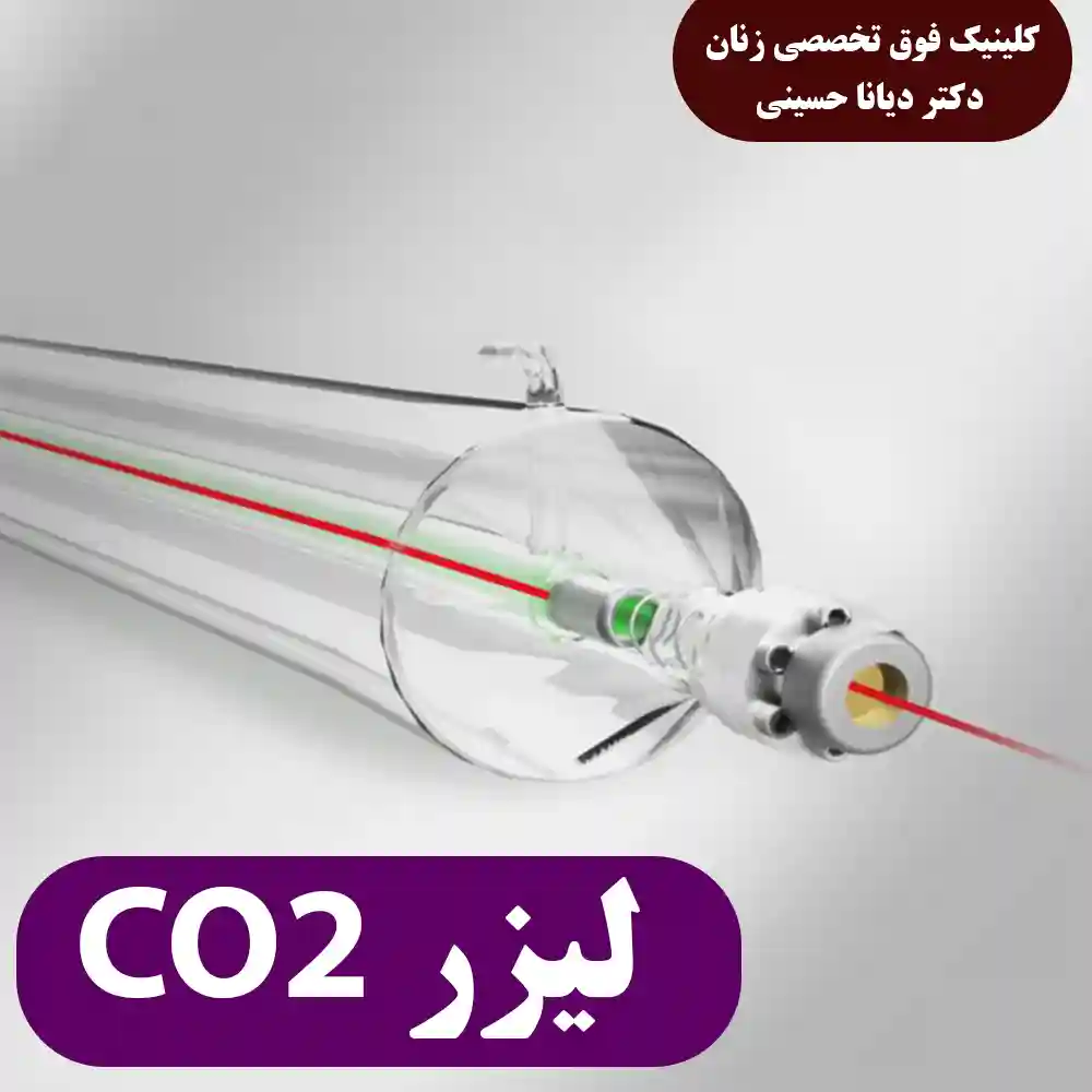 لیزر CO2