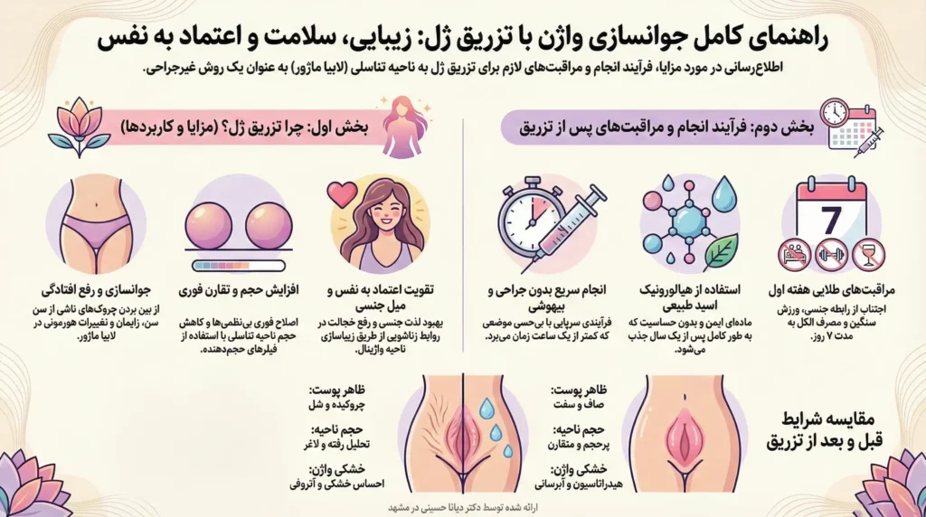 اینفوگرافیک راهنمای کامل جوانسازی واژن با تزریق ژل