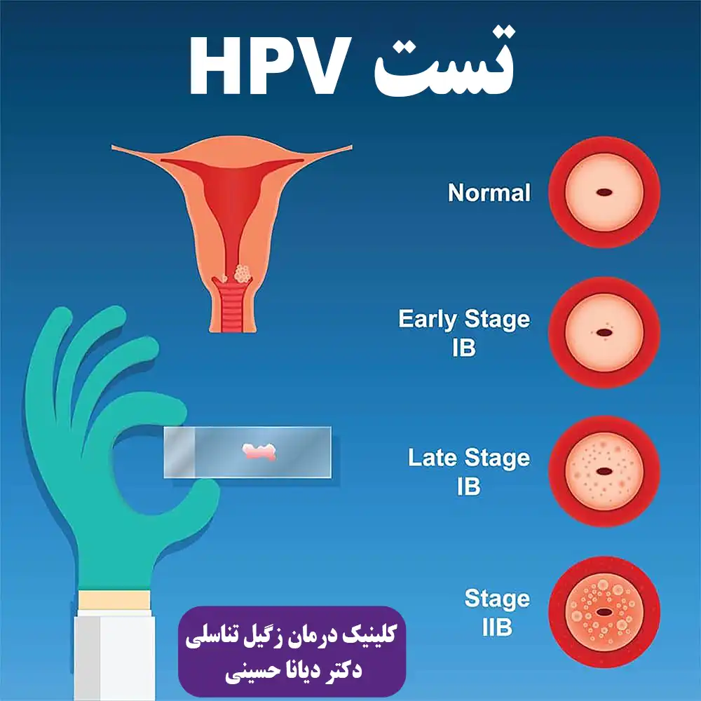 تست اچ پی وی