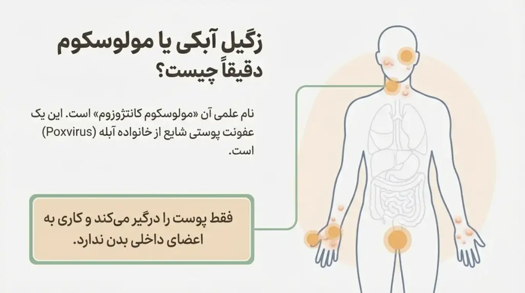 زگیل آبکی یا مولوسکوم دقیقا چیست؟
