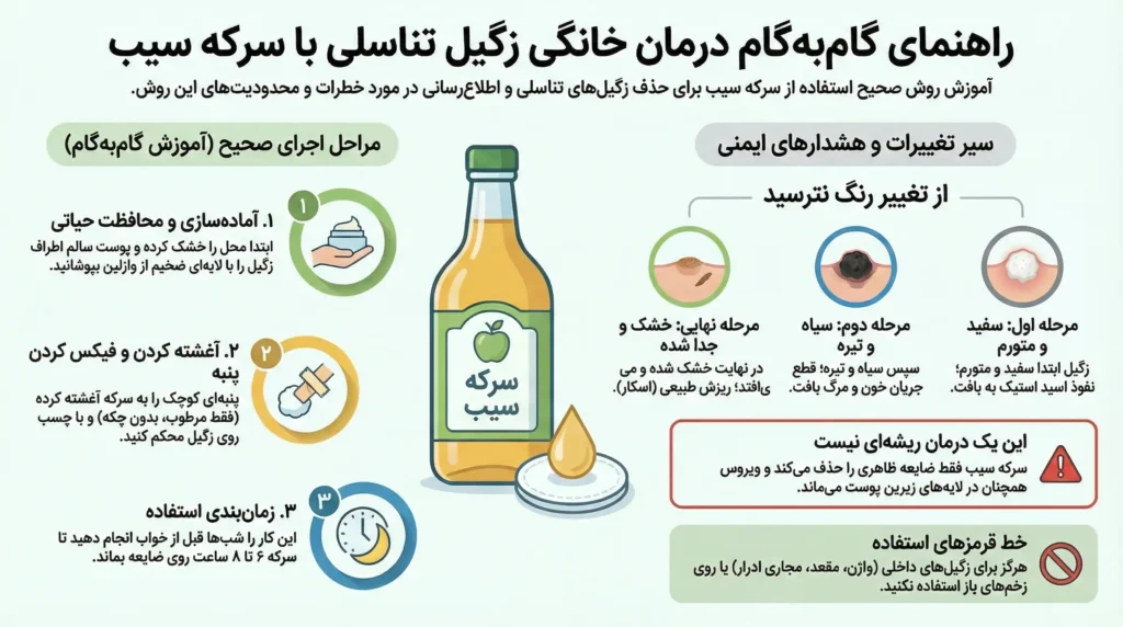 راهنمای کامل و گام به گام درمان زگیل تناسلی با سرکه سیب