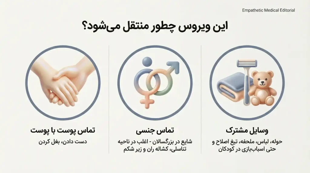 راههای انتقال مولوسکوم و زگیل آبکی