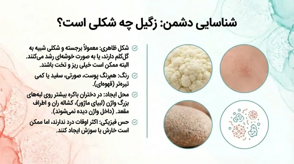 شکل ظاهری زگیل تناسلی