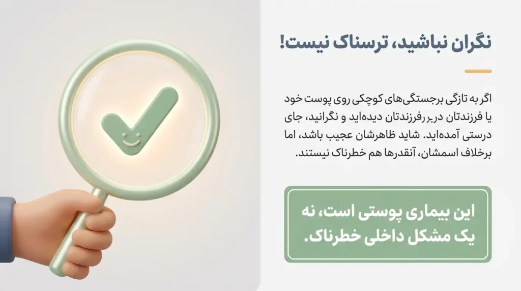 عدم خطرناک بودن مولوسکوم و زگیل آبکی