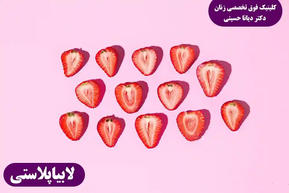 عمل لابیاپلاستی با لیزر در کلینیک فوق تخصصی دکتر دیانا حسینی