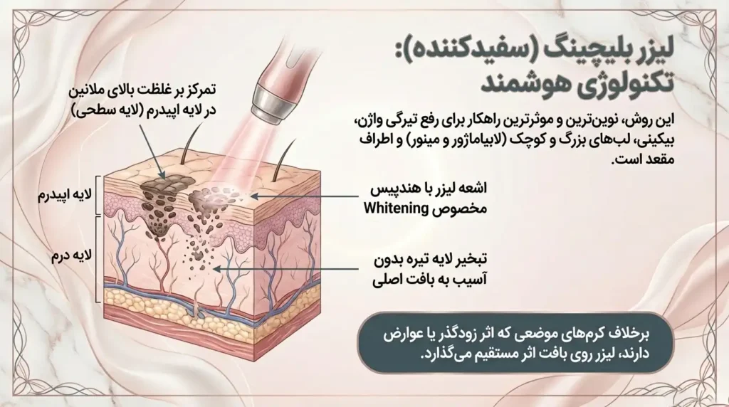 لیزر بلیچینگ و سفید کننده و رفع تیرگی واژن یک تکنولوژی هوشمند و نوین است