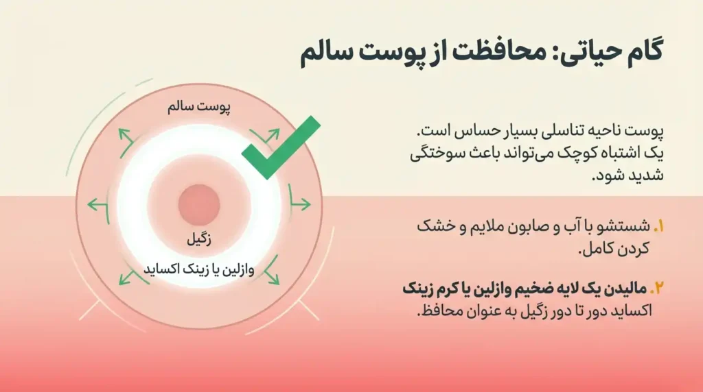 محافظت از پوست حین درمان زگیل تناسلی با سرکه سیب