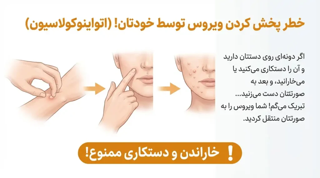 پخش کردن مولوسکوم و زگیل آبکی توسط خودمان