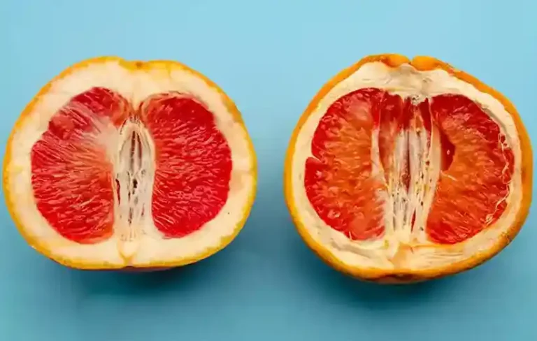 دکتر دیانا حسینی بهترین متخصص لابیاپلاستی در مشهد