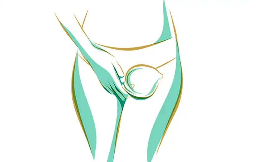 زگیل تناسلی و اچ پی وی در دختر مجرد