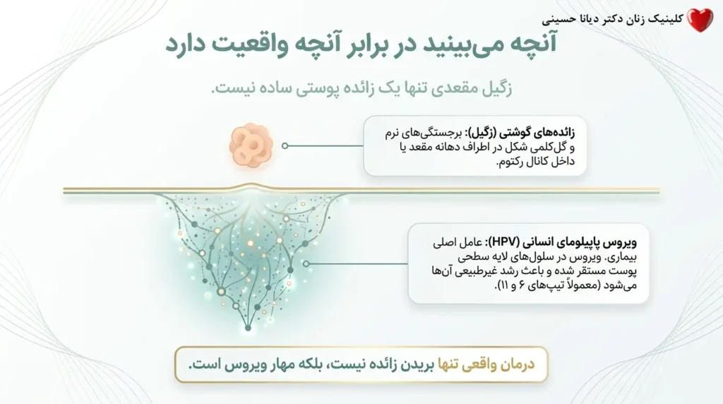 آنچه باید درباره زگیل مقعدی بدانید
