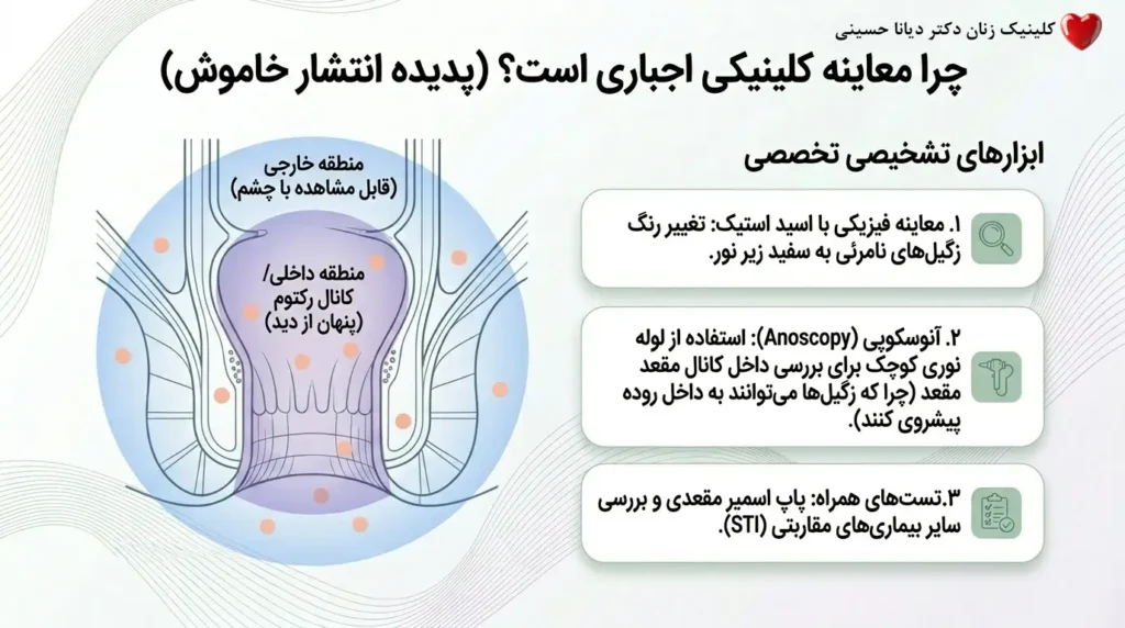 ابزارهای تشخیصی زگیل مقعدی