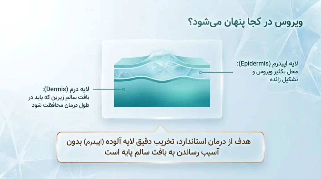 ویروس اچ پی وی کجا پنهان میشود