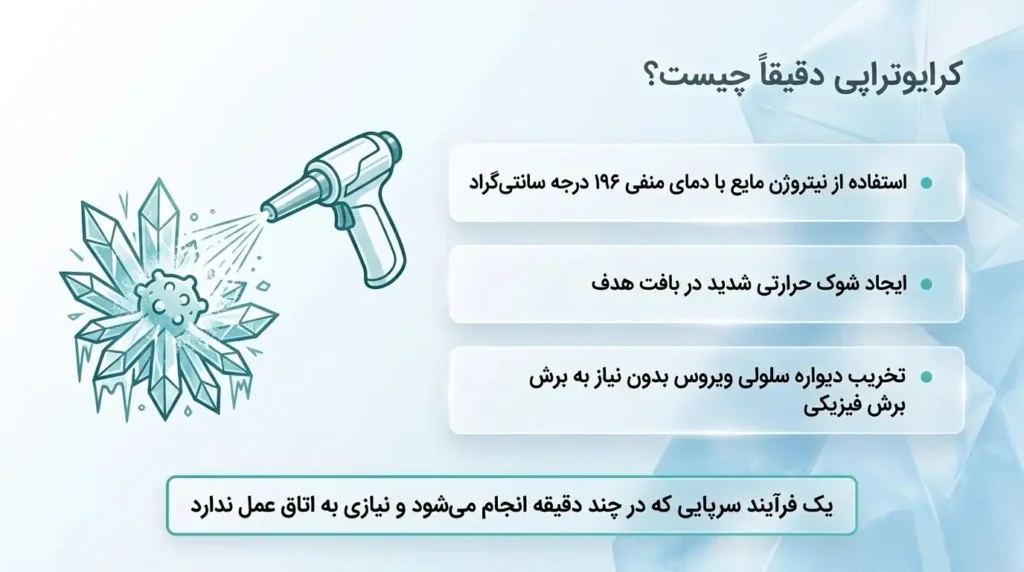 کرایوتراپی چگونه زگیل تناسلی را درمان میکند؟