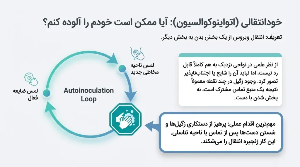 آیا ممکن است خودم با دست زگیل تناسلی را به خودم منتقل کنم؟