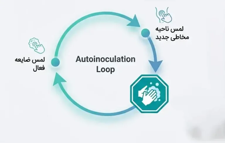 آیا از دست ها زگیل تناسلی منتقل میشود؟